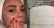 Victoria Beckham używa kremu z własną krwią za... prawie 6 tysięcy złotych