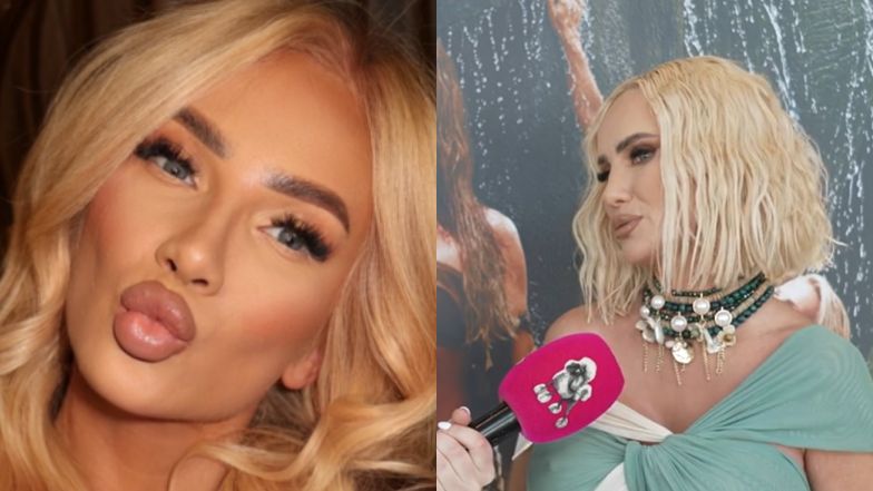 Izabela Macudzińska wymienia, co sobie poprawiła i uspokaja: "Nie jestem zwolenniczką medycyny estetycznej. Ja się NIE OSTRZYKUJĘ" (WIDEO)