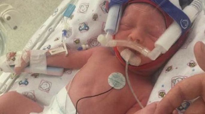 Eleanor przyszła na świat 4 tygodnie przed terminem. Jej mama zmarła