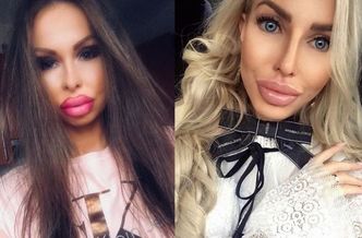 "Influencerka" z Radomia odcina się od wielkoustej Anelli: "Stawiam na SAMOROZWÓJ!"