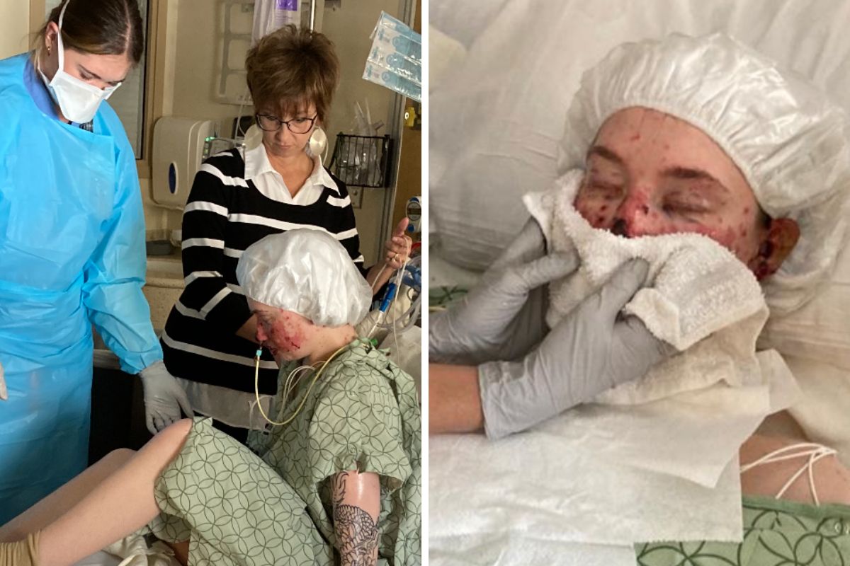 Stan Kayli powoli się poprawia, ale rokowania lekarzy są ostrożne