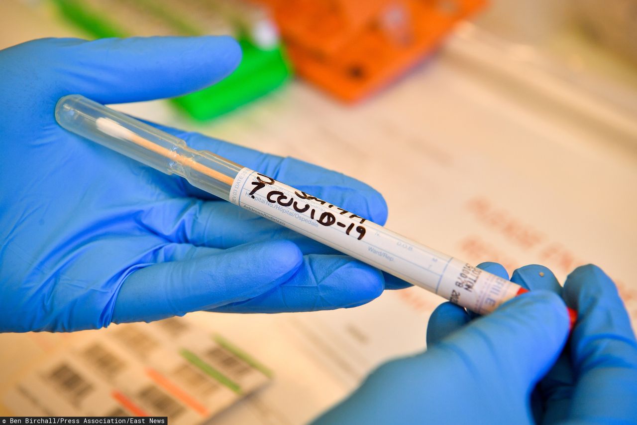 Australijscy badacze odkryli, jak układ odpornościowy walczy z koronawirusem