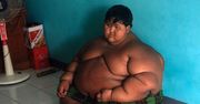 Najgrubsze dziecko świata schudło 106 kilogramów