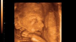 Płód w 27 tygodniu ciąży (zdjęcia)