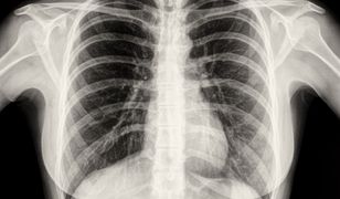 GIF interweniuje. Uwaga na wycofany lek