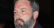 Ben Affleck znowu trafił na odwyk. To już trzeci raz w tym roku