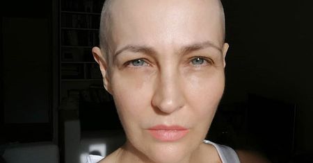 Anna Puślecka choruje na raka. Może liczyć na wsparcie gwiazd