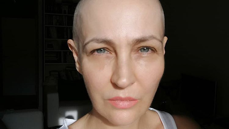 Anna Puślecka choruje na raka. Może liczyć na wsparcie gwiazd