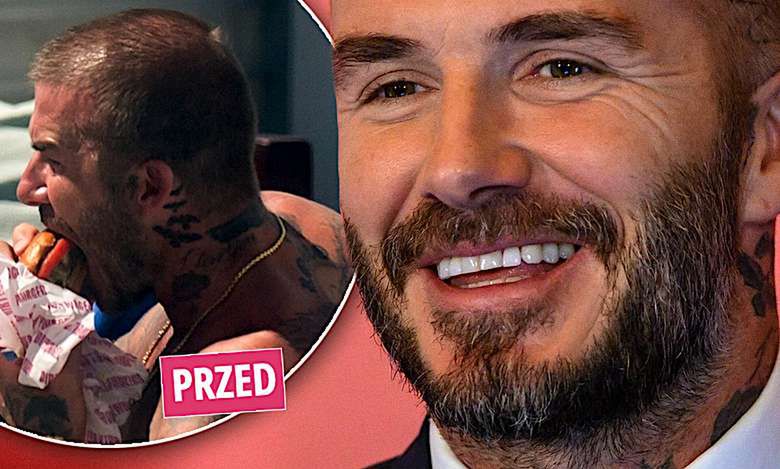 David Beckham pokazał się po przeszczepie włosów! Różnica jest gigantyczna!