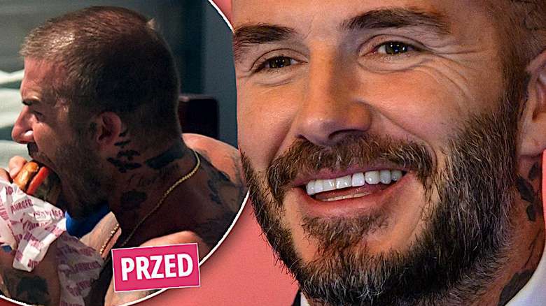 David Beckham przeszczep włosów efekty