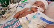 Miała przeżyć 6 godzin. Dziewczynka świętuje pierwsze urodziny