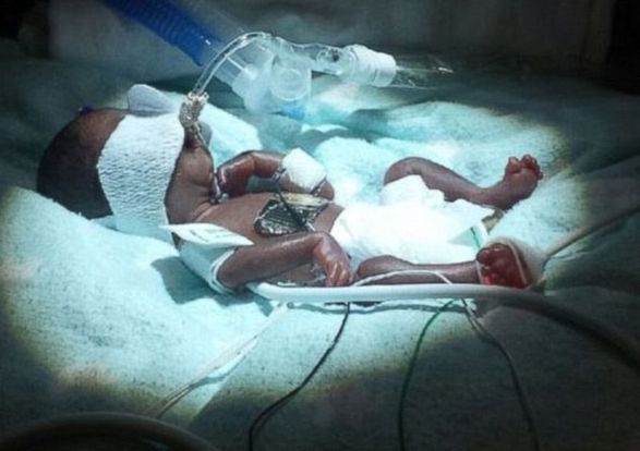 Jedno z najmłodszych dzieci świata opuści szpital