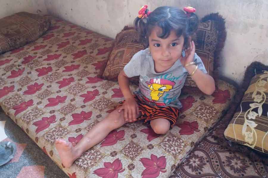 Potrzebna pilna pomoc dla trzyletniej Maysy z Syrii. Dziecko straciło nogę
