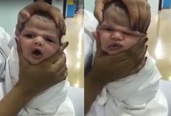 Szokujące zachowanie pielęgniarek. Dla zabawy ściskały twarz noworodka