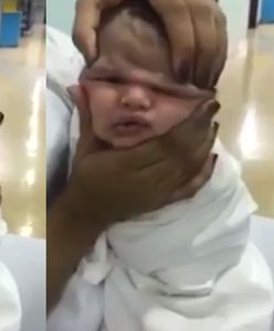 Szokujące zachowanie pielęgniarek. Dla zabawy ściskały twarz noworodka