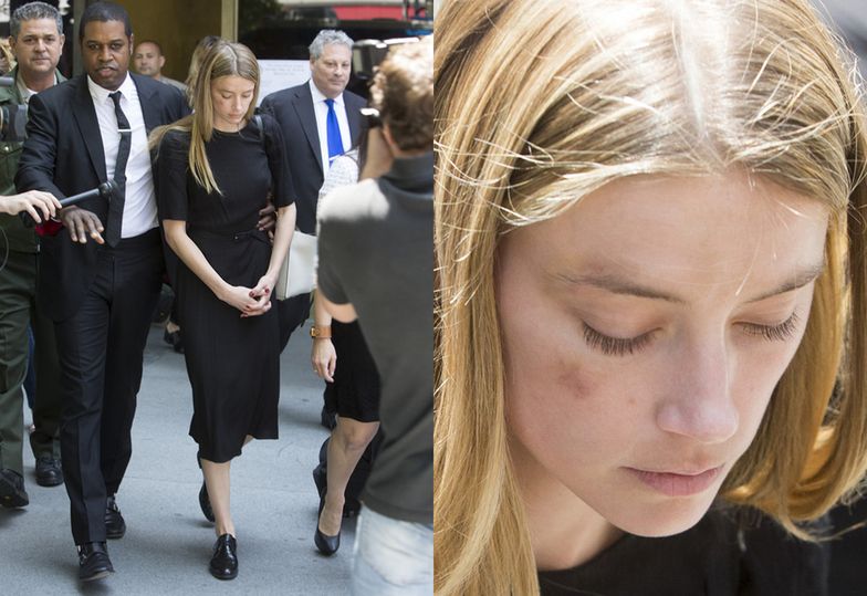 Pobita Amber Heard wychodzi z sądu