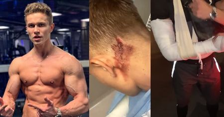 Łukasz z "Hotelu Paradise" został BRUTALNIE NAPADNIĘTY! "Rozcięta głowa, złamanie z przemieszczeniem"