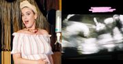 Nienarodzona córka Katy Perry pokazała jej ŚRODKOWY PALEC podczas badania USG... (WIDEO)