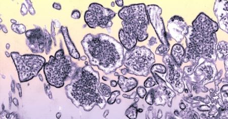 Nowa groźna choroba z Chin. Wirus Nipah zabija 75 proc. zarażonych