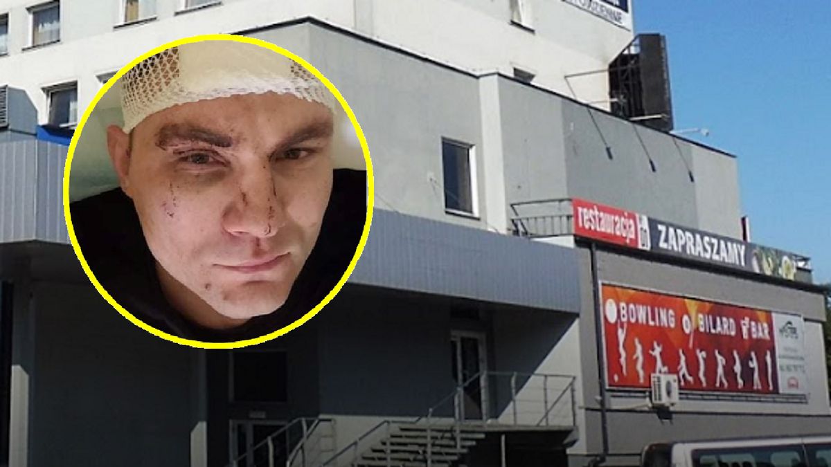 Wokalista disco polo dostał toporkiem w głowę