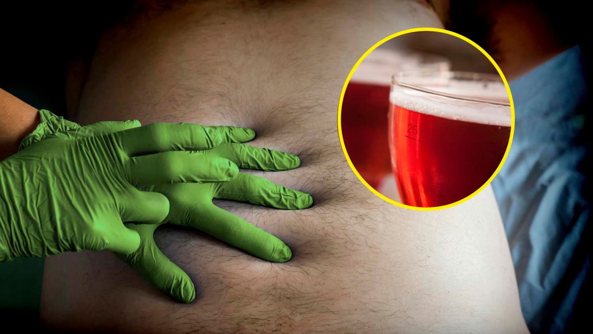 Badania: Naukowcy wskazali czynnik, który zwiększa ryzyko raka jelita o 26 proc.