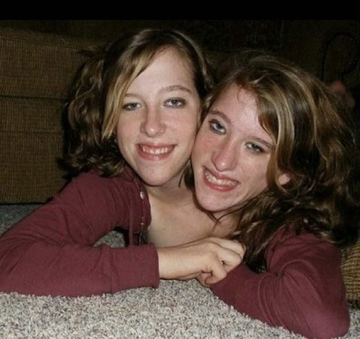 Abby i Brittany Hensel 