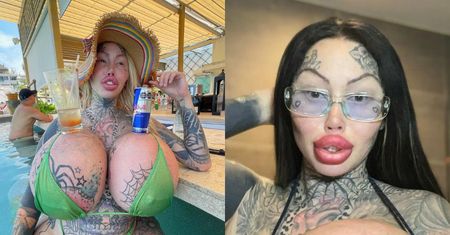 Influencerka uzależniona od chirurgii plastycznej oznajmia, że WYBUCHŁ jej implant piersi. Ważył aż 10 kg! (ZDJĘCIA)
