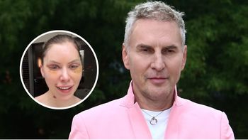 Julia von Stein zrobiła lifting twarzy. Gojdź zabrał głos: "NIEPOROZUMIENIE"