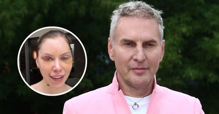 Julia von Stein zrobiła lifting twarzy. Gojdź zabrał głos: "NIEPOROZUMIENIE"