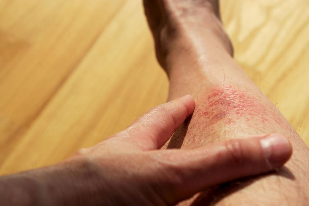 Nieoczywiste objawy chorób jelit