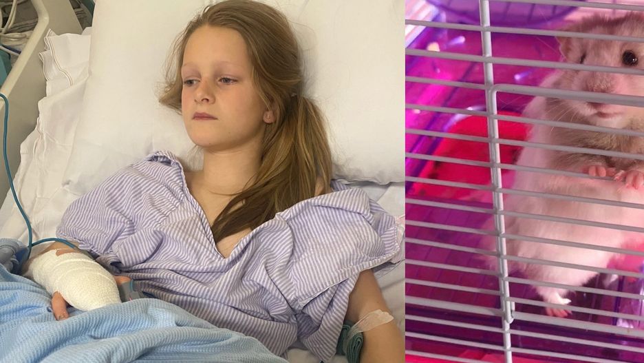 Dziewczynka pogryziona przez chomika