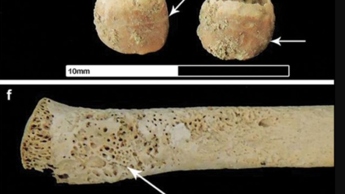 Rzymska okupacja nie wyszła mieszkańcom Brytanii na zdrowie