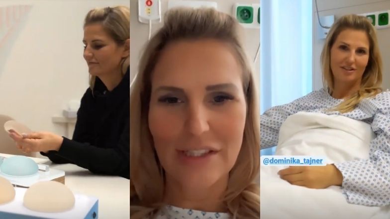 Dominika Tajner poddała się operacji rekonstrukcji piersi
