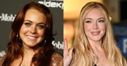 Twarz Lindsay Lohan wyraźnie ewoluowała. Lekarz medycyny estetycznej WYLICZYŁ zabiegi, jakim się poddała