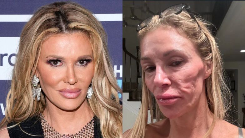 Brandi Glanville obudziła się "starsza o 20 lat". Zaatakował ją 