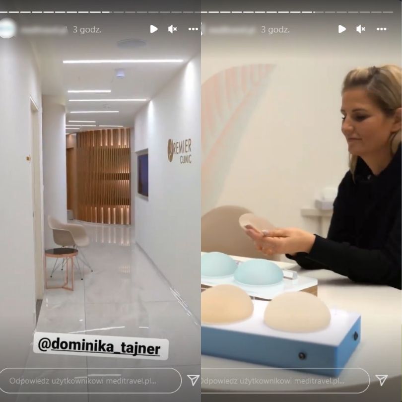 Dominika Tajner poddała się operacji rekonstrukcji piersi
