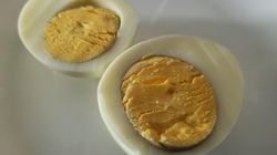 Cholina a zaburzenia lękowe. To problem nawet 30 proc. z nas