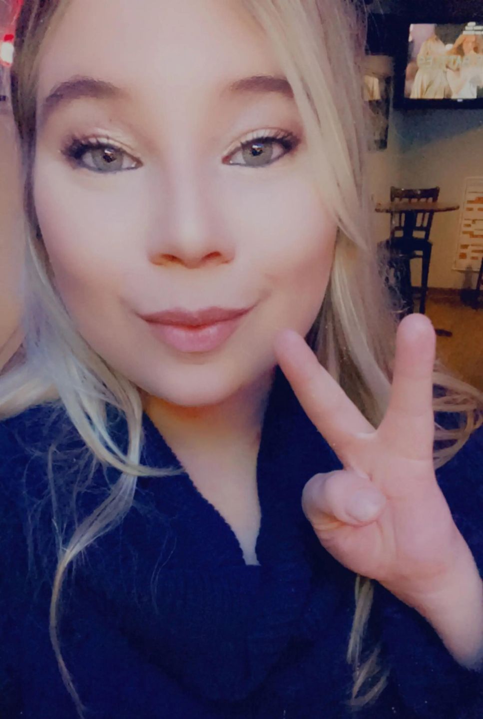 Cassidy przez wadę wrodzoną stała sie obiektem żartów