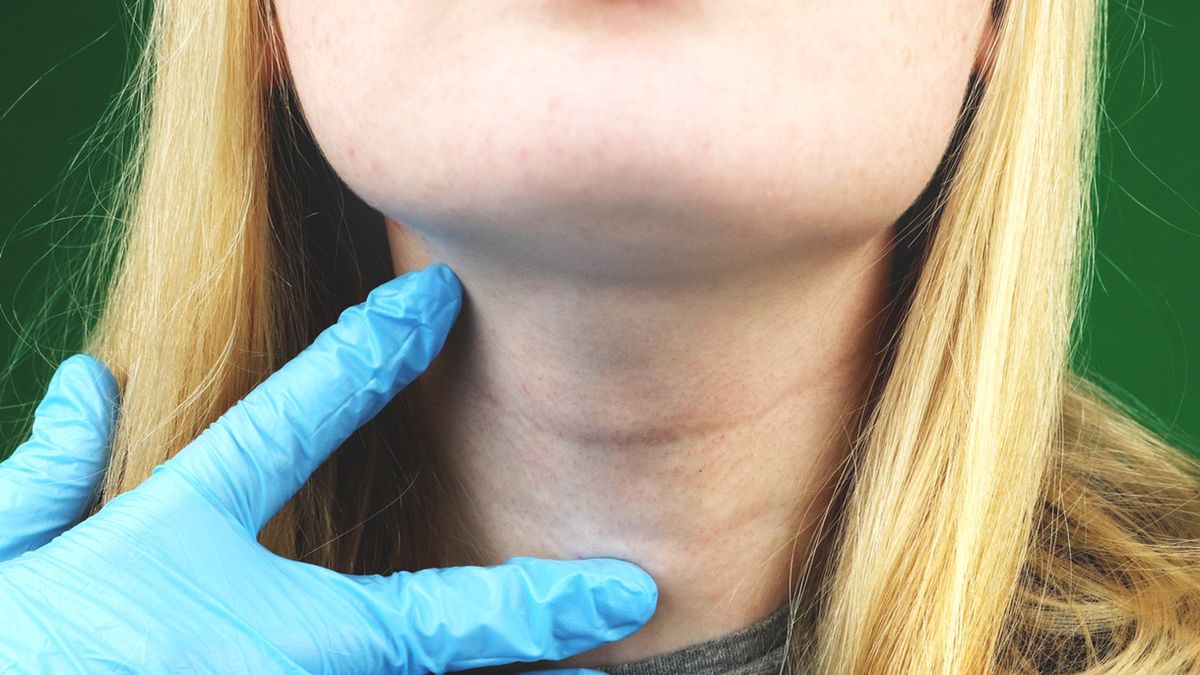 Powiększone węzły chłonne - nie bagatelizuj tego objawu