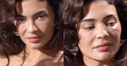 Internauci zaniepokojeni wyglądem Kylie Jenner: "Co ona ma pod oczami?". Ekspertka ocenia (ZDJĘCIA)