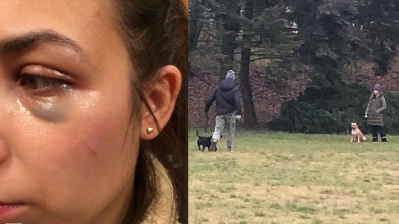 Kobieta zwróciła uwagę właścicielowi psa i został pobita. Internauci podejrzewają rapera Dominika Kaczmarka.