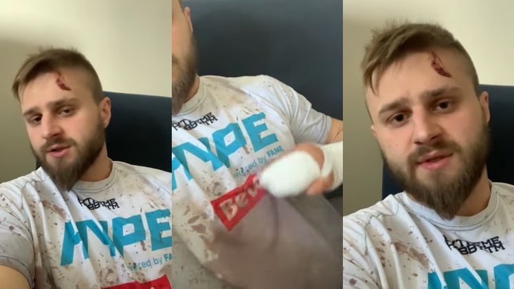 Gwiazdor Fame MMA został napadnięty we własnym domu?!
