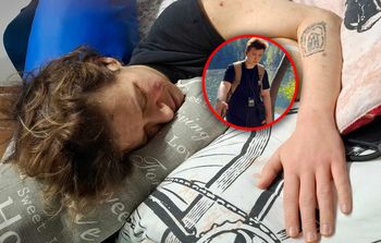 Ma rzadką mutację genetyczną. Groźna choroba uaktywniła się po narkozie