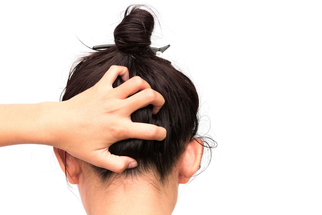 Swędząca skóra głowy – przyczyny i sposoby walki z dolegliwością