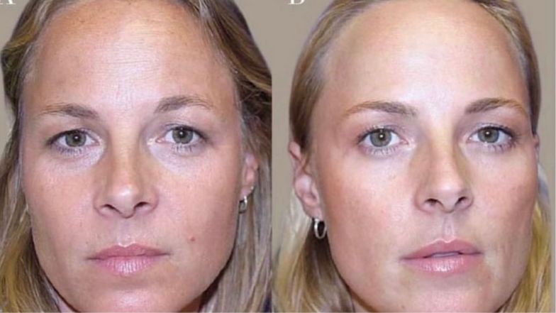 Która z sióstr wygląda młodziej?