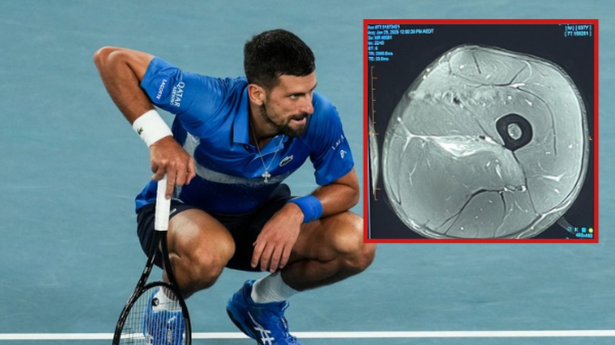 Djoković krytykuje "ekspertów" od kontuzji. Pokazuje MRI nogi