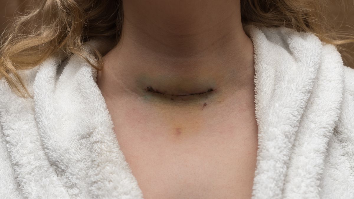 Jakie czynniki zwiększają ryzyko raka tarczycy?