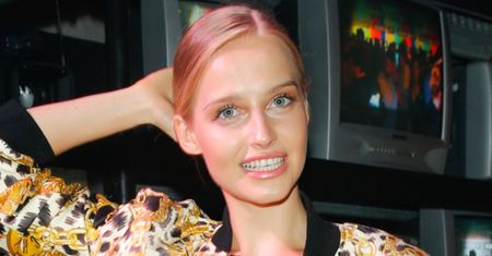 Karolina Pisarek pokazuje wypryski u kosmetyczki: "Jeżeli ktoś myśli, że ludzie z Instagrama są idealni, to tu odpowiedź" (FOTO)