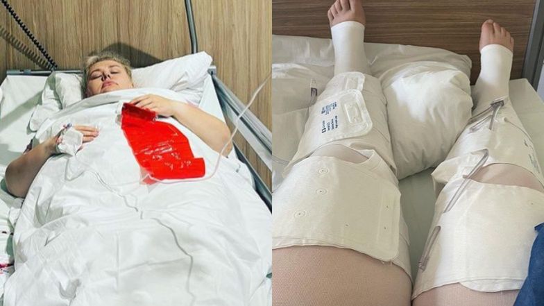 Kinga Zawodnik przeszła operację zmniejszenia żołądka