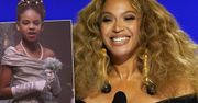 Grammy 2021. Beyonce na gali odebrała nagrodę dla Blue Ivy. Wyglądała zjawiskowo, tylko co się stało z jej twarzą?